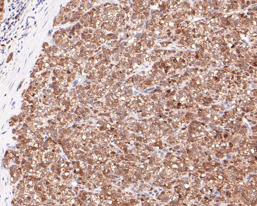 CRCP Antibody (JE65-42)