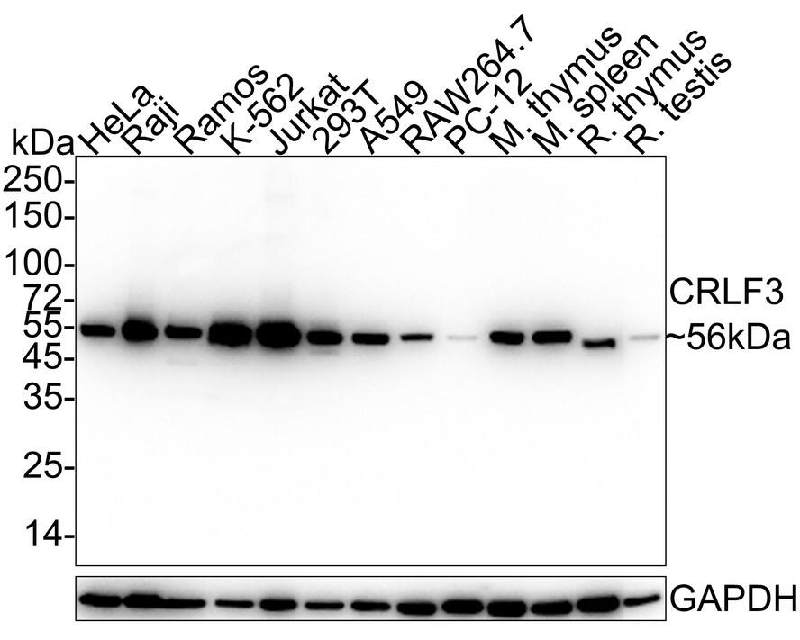 CRLF3 Antibody (PSH03-88)