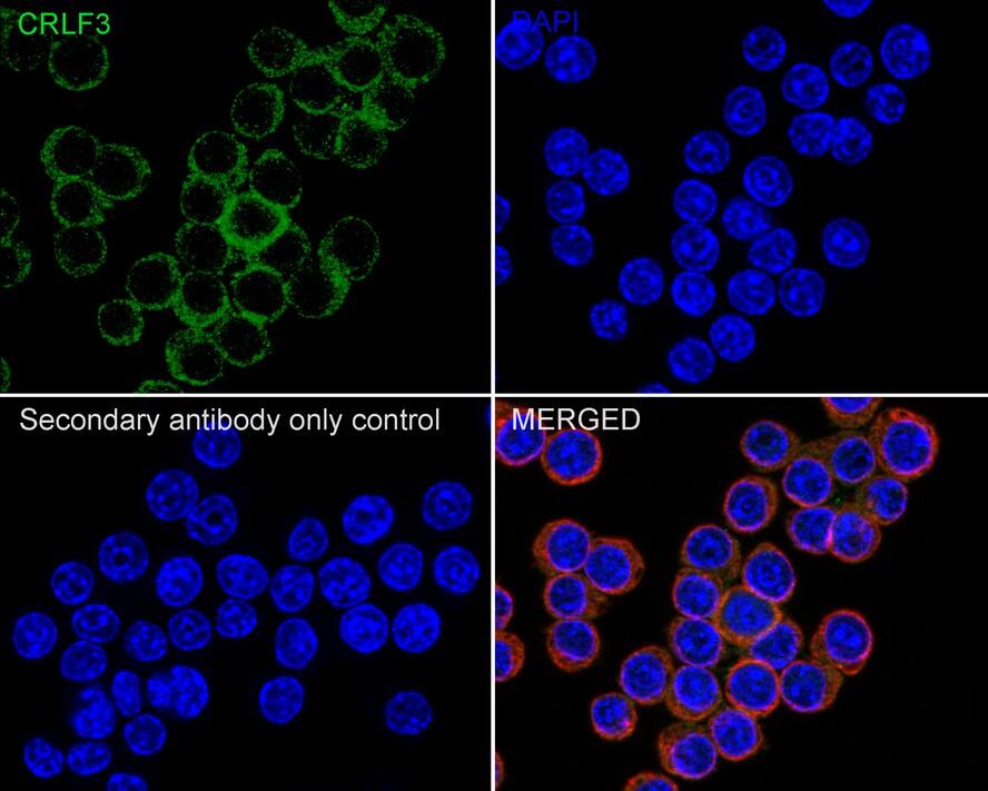 CRLF3 Antibody (PSH03-88)