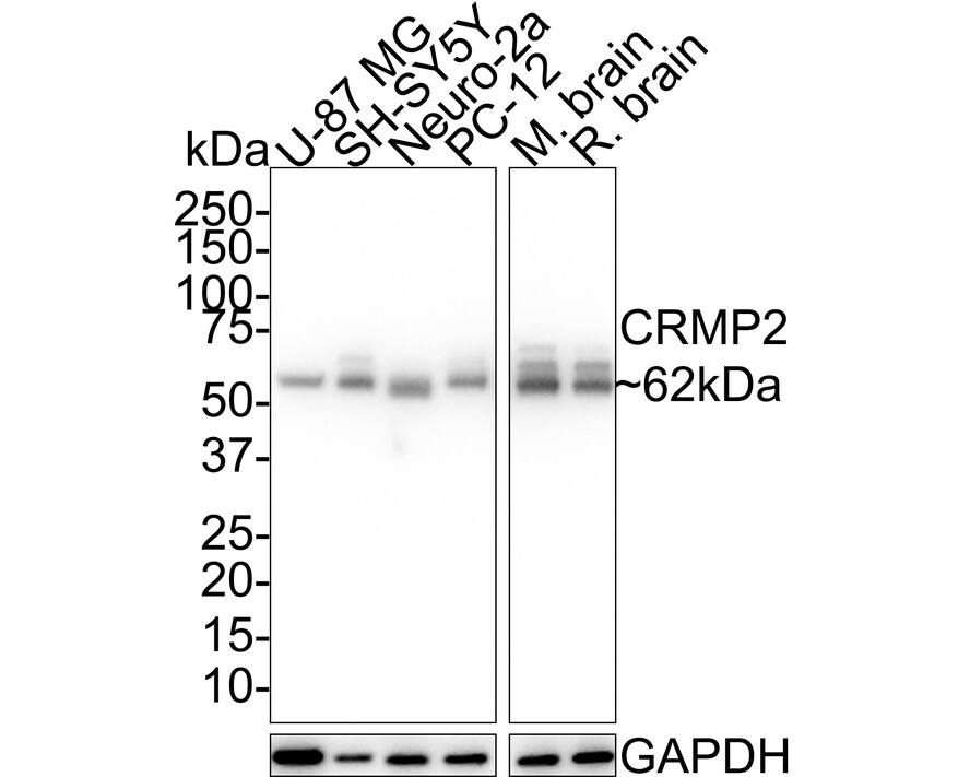 CRMP2 Antibody (JE31-53)