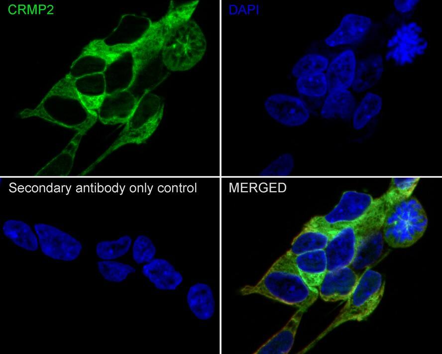 CRMP2 Antibody (JE31-53)