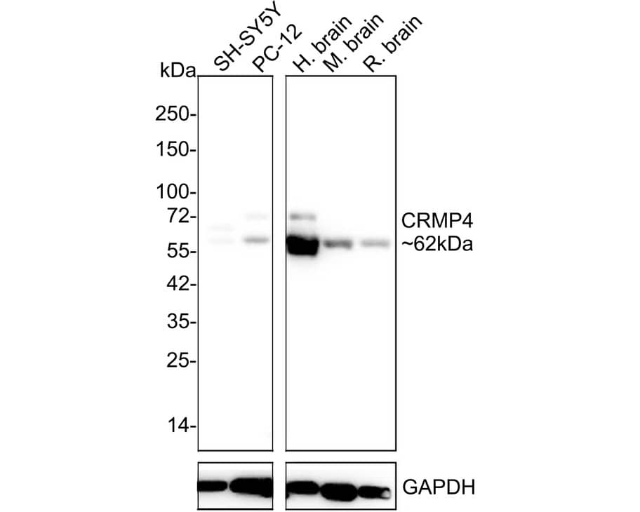 CRMP4 Antibody (JE55-99)