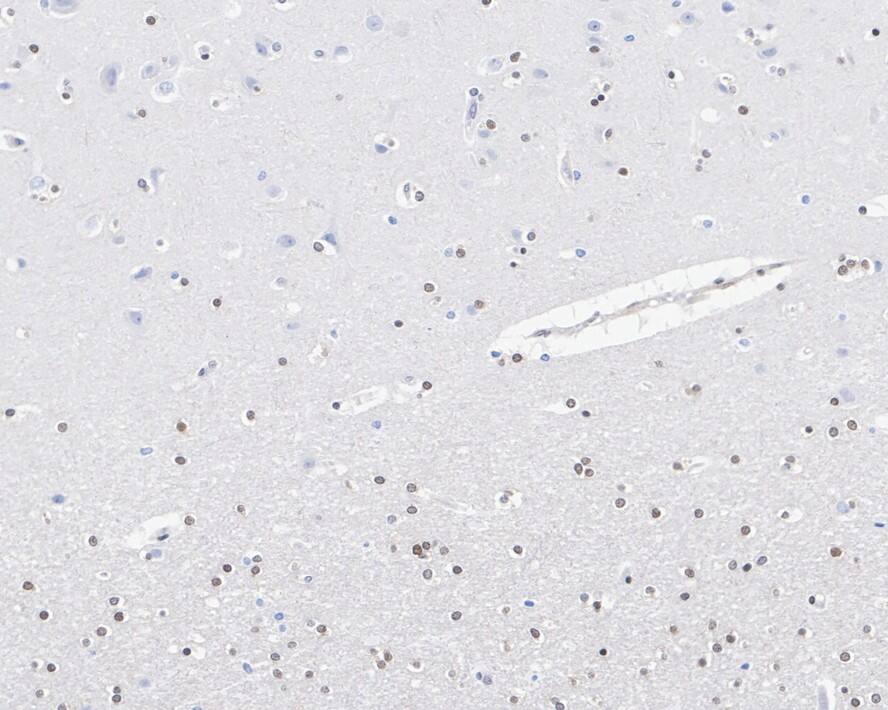 TORC3/CRTC3 Antibody (JE63-18)