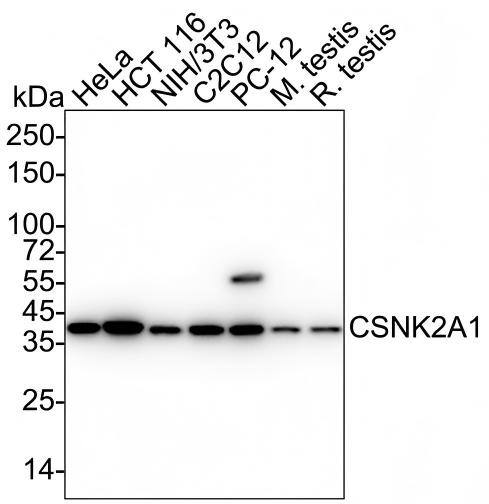 Casein Kinase 2 alpha Antibody (PSH04-54) Western Blot: Casein Kinase 2 alpha Antibody (PSH04-54) [NBP3-32228]