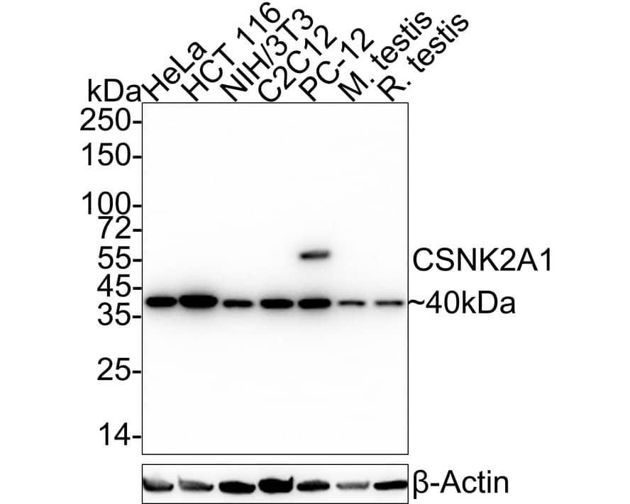 Casein Kinase 2 alpha Antibody (PSH04-54)