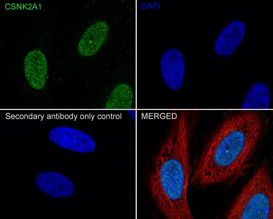 Casein Kinase 2 alpha Antibody (PSH04-54)