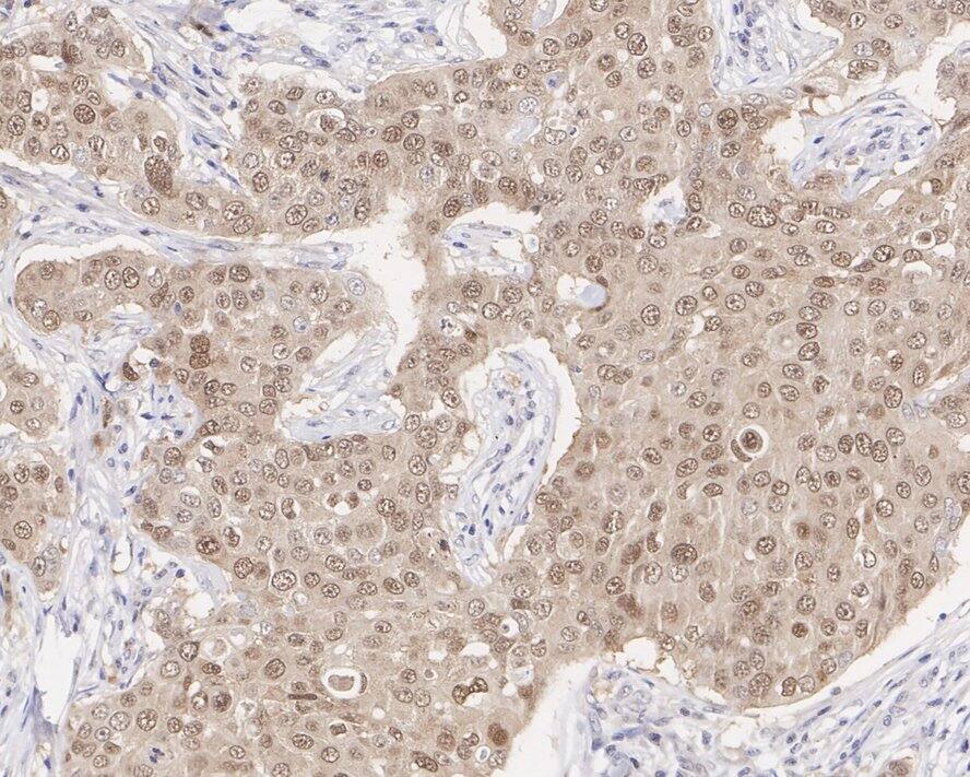 Casein Kinase 2 alpha Antibody (PSH04-54)