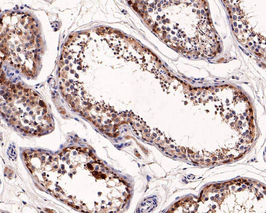 CTAG1B Antibody (PD00-87)