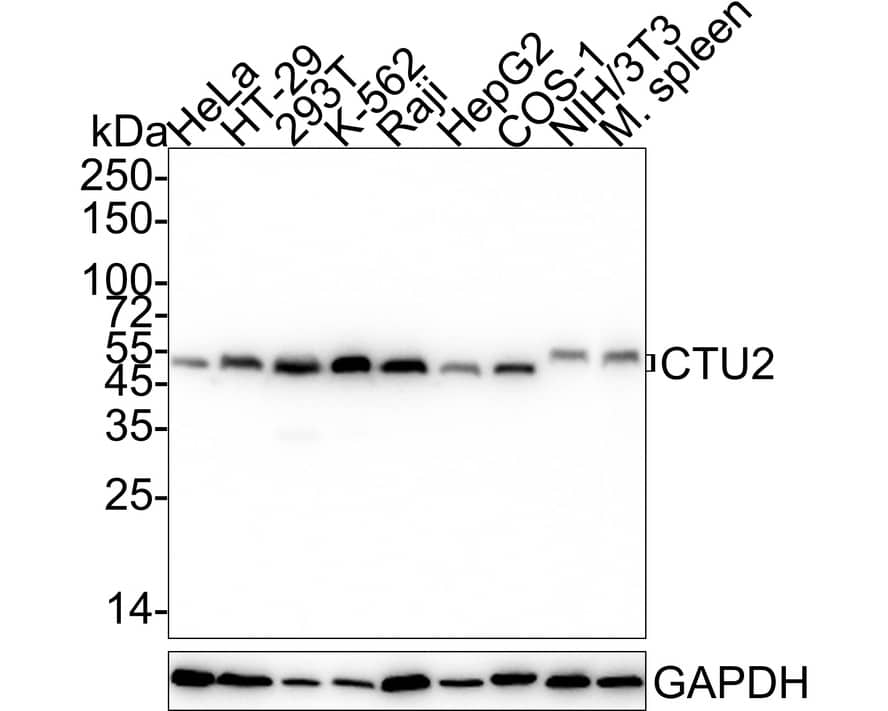 CTU2 Antibody (PSH04-05)