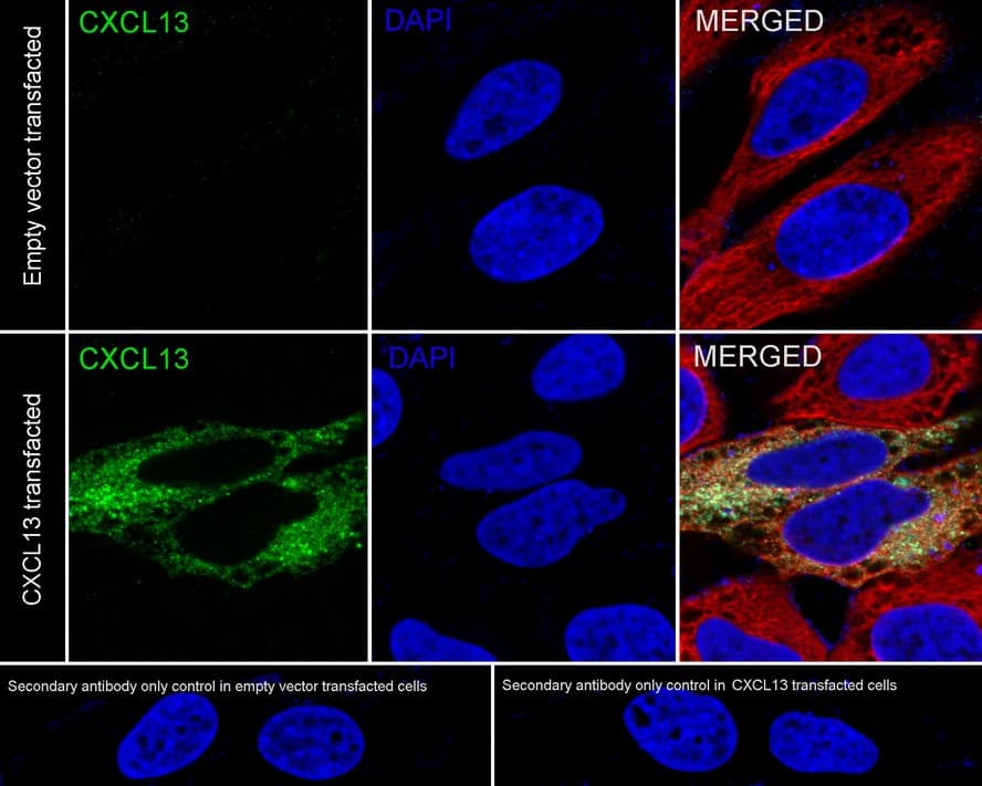 CXCL13/BLC/BCA-1 Antibody (PSH04-34)