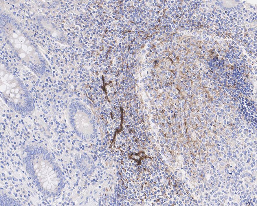 CXCL13/BLC/BCA-1 Antibody (PSH04-34)