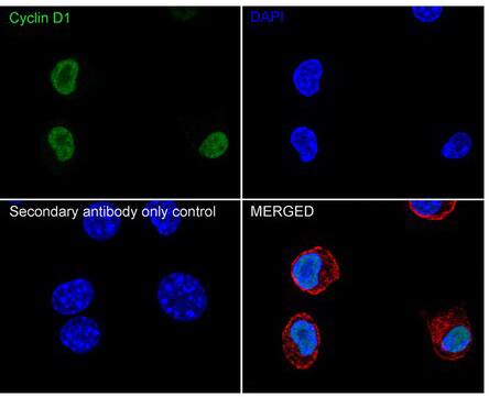 Cyclin D1 Antibody (PD01-64)