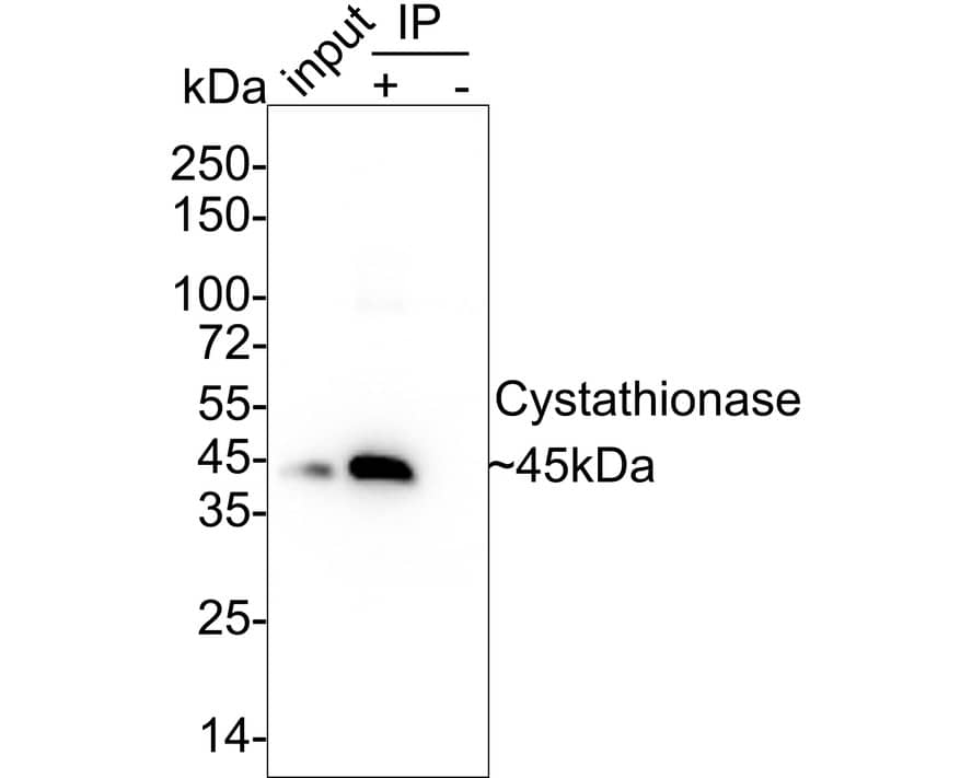 Cystathionase Antibody (JE35-91)