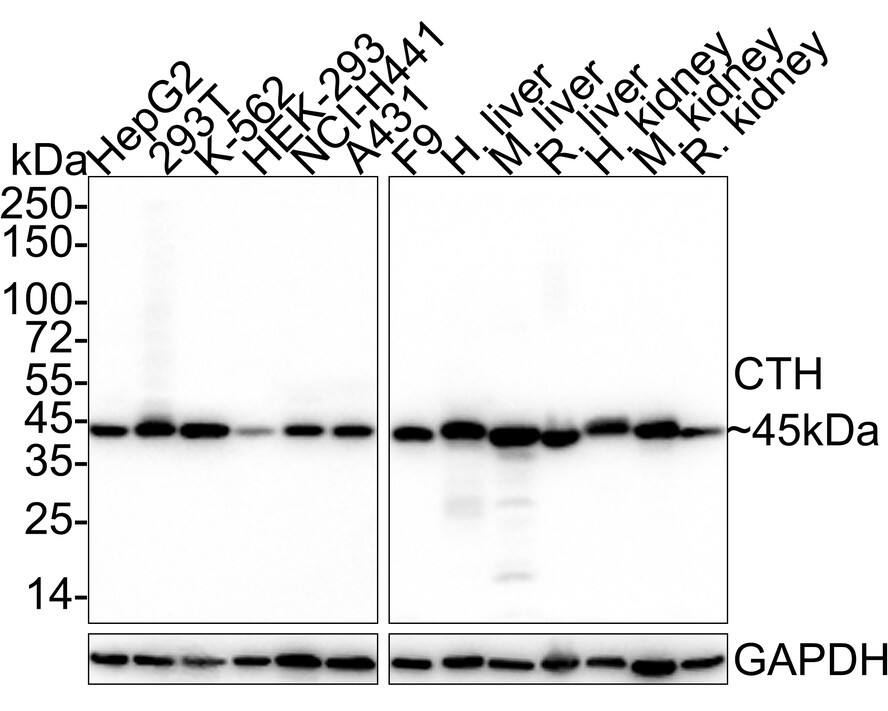 Cystathionase Antibody (JE35-91)