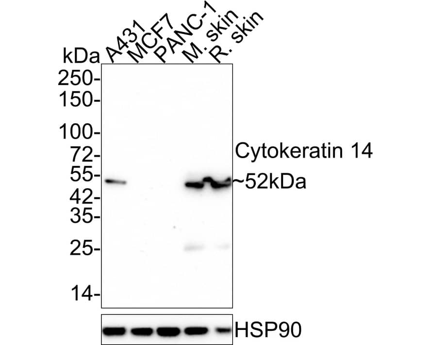 Cytokeratin 14 Antibody (A2C11-R)