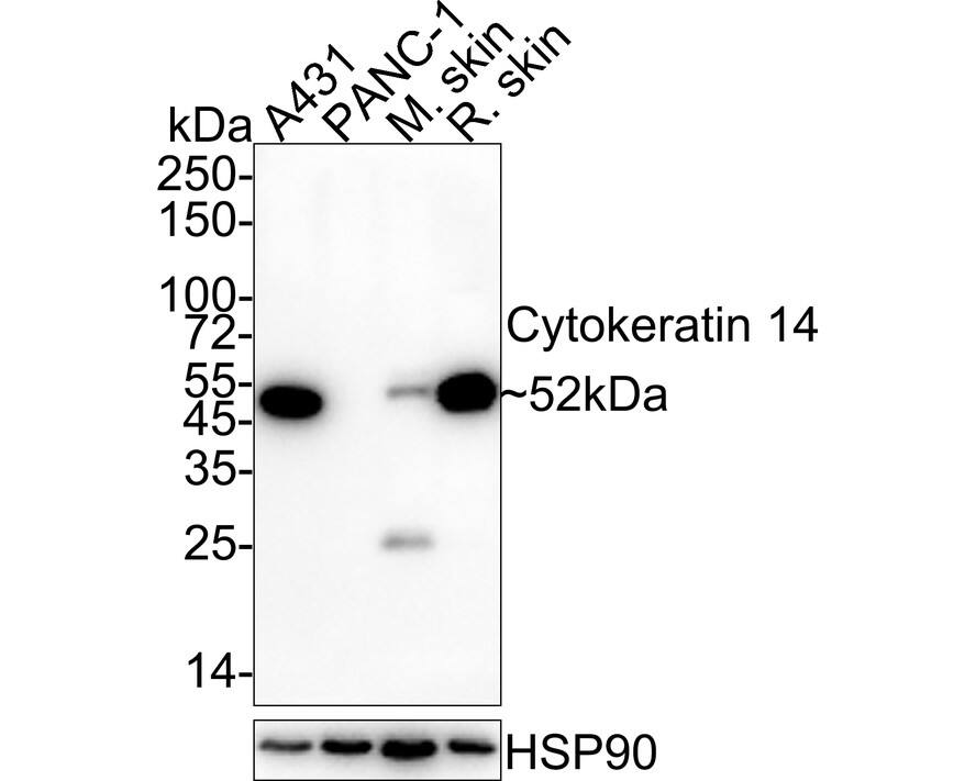 Cytokeratin 14 Antibody (A2C10-R)