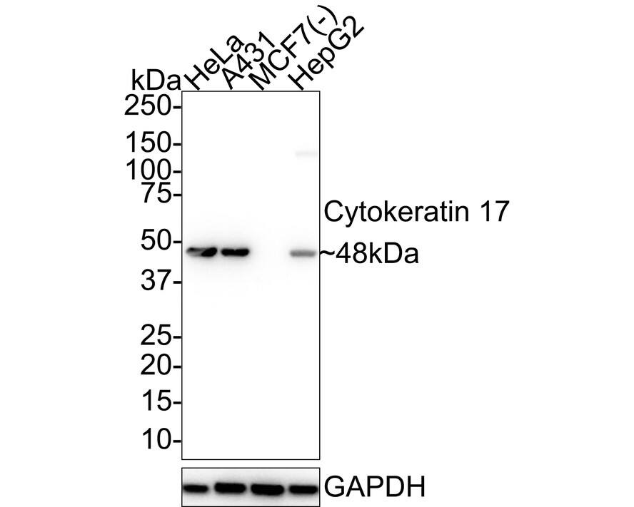 Cytokeratin 17 Antibody (A2B10-R) Western Blot: Cytokeratin 17 Antibody (A2B10-R) [NBP3-32244]