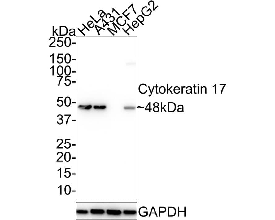 Cytokeratin 17 Antibody (A2B10-R)