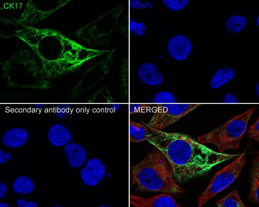 Cytokeratin 17 Antibody (A2B10-R)