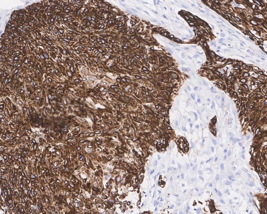 Cytokeratin 17 Antibody (A2B10-R)