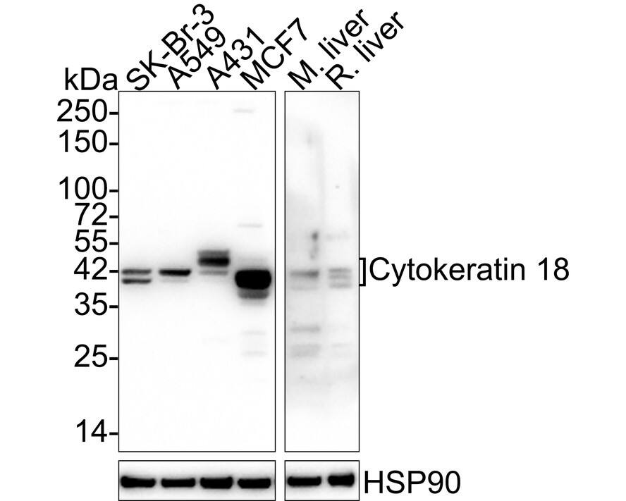 Cytokeratin 18 Antibody (A4B3-R)