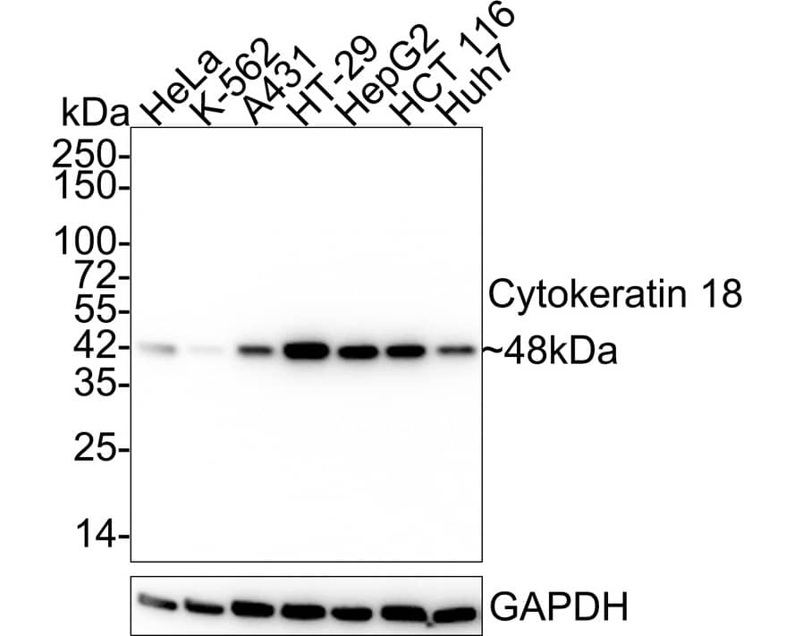 Cytokeratin 18 Antibody (6-19-R)