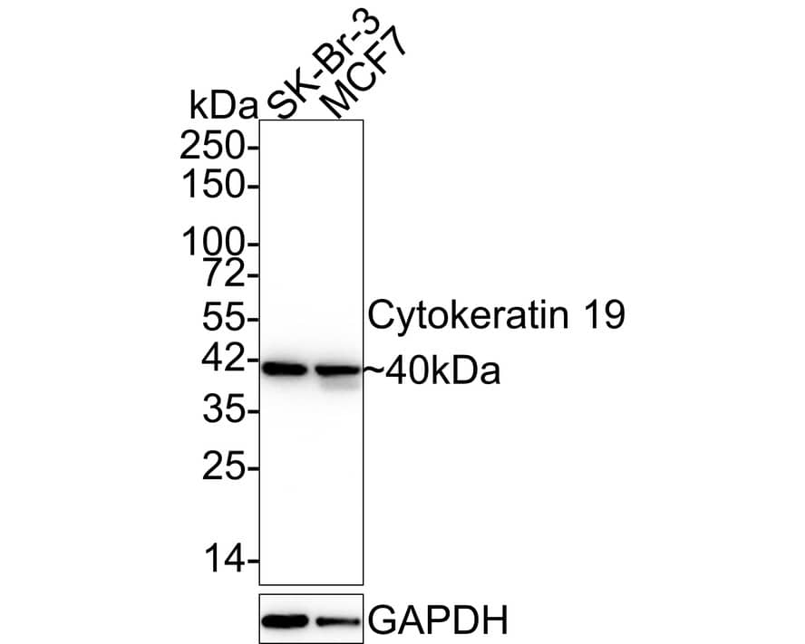 Cytokeratin 19 Antibody (A3D1-R)