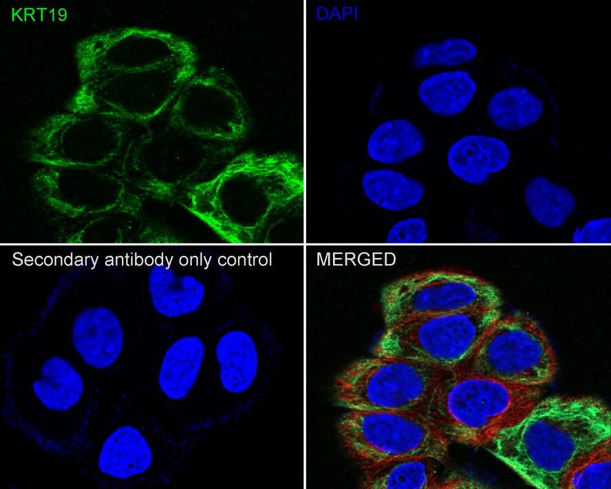 Cytokeratin 19 Antibody (A3D1-R)