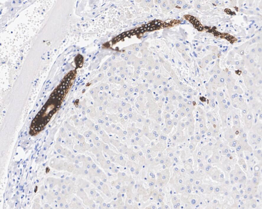Cytokeratin 19 Antibody (A3D1-R)