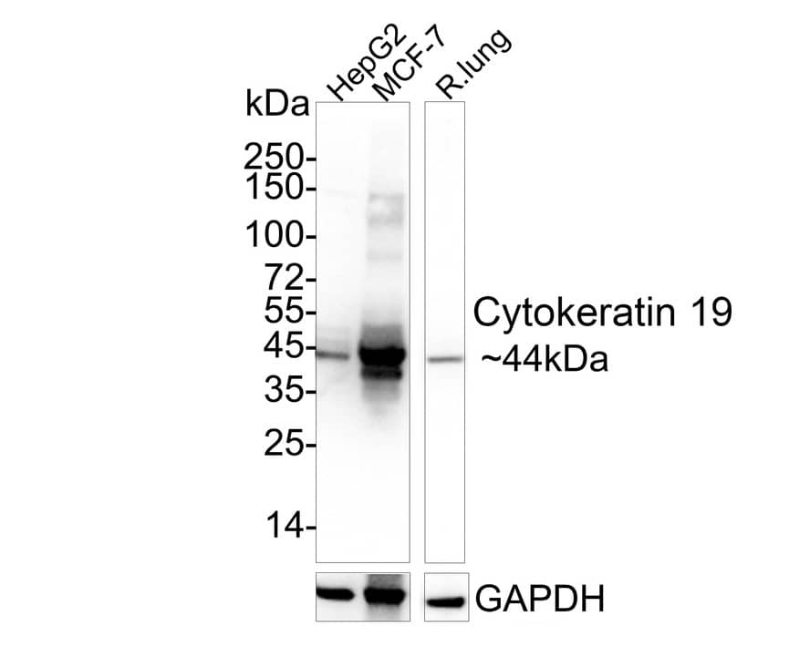 Cytokeratin 19 Antibody (SA30-06) Western Blot: Cytokeratin 19 Antibody (SA30-06) [NBP3-32248]