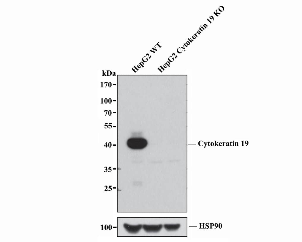 Cytokeratin 19 Antibody (SA30-06)