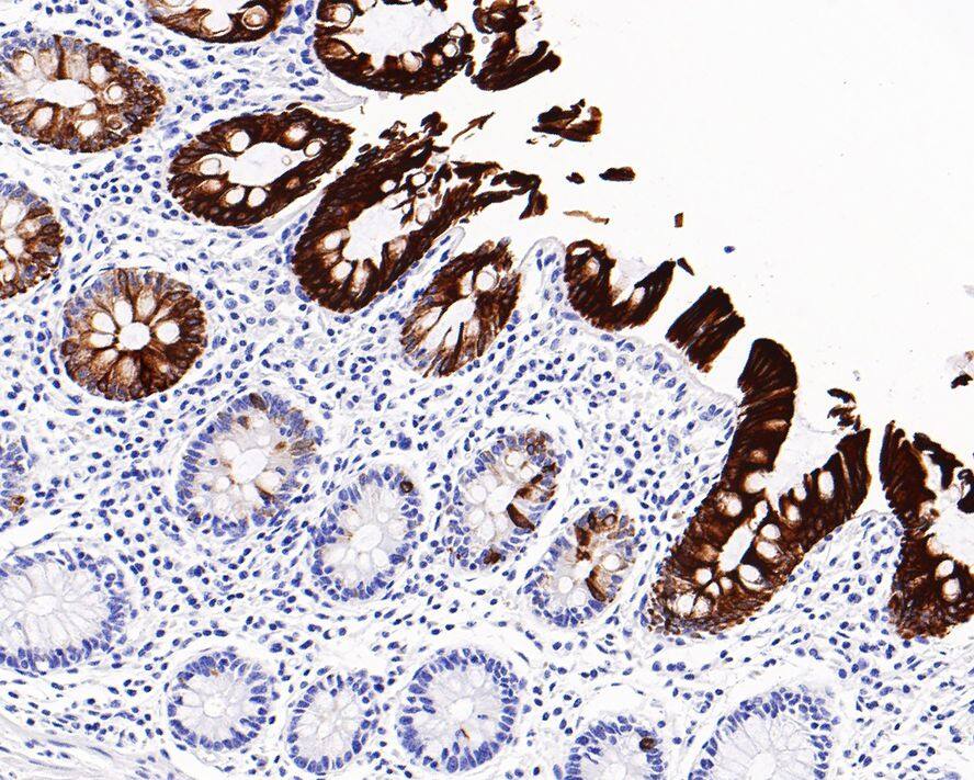 Cytokeratin 20 Antibody (A3H7-R)