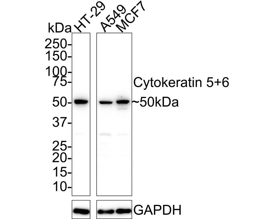 Cytokeratin 5/6 Antibody (A2B2-R)