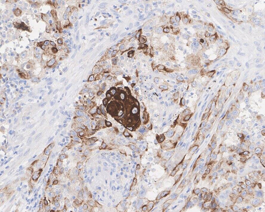 Cytokeratin 5/6 Antibody (A2B2-R)