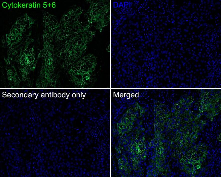 Cytokeratin 5/6 Antibody (PSH0-67)