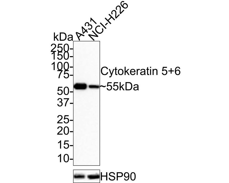 Cytokeratin 5/6 Antibody (PSH0-68)