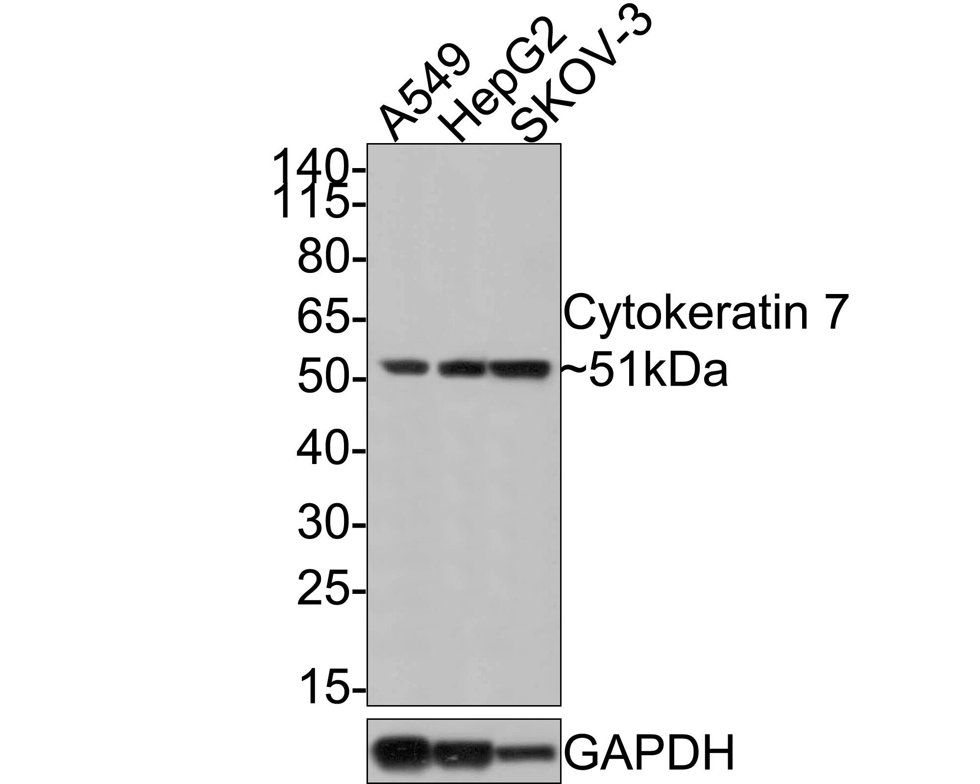 Cytokeratin 7 Antibody (3-G3-D8-R)