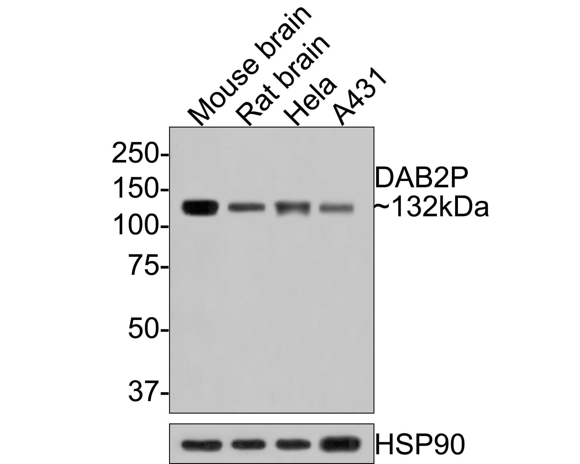 DAB2IP Antibody