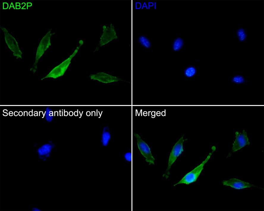 DAB2IP Antibody