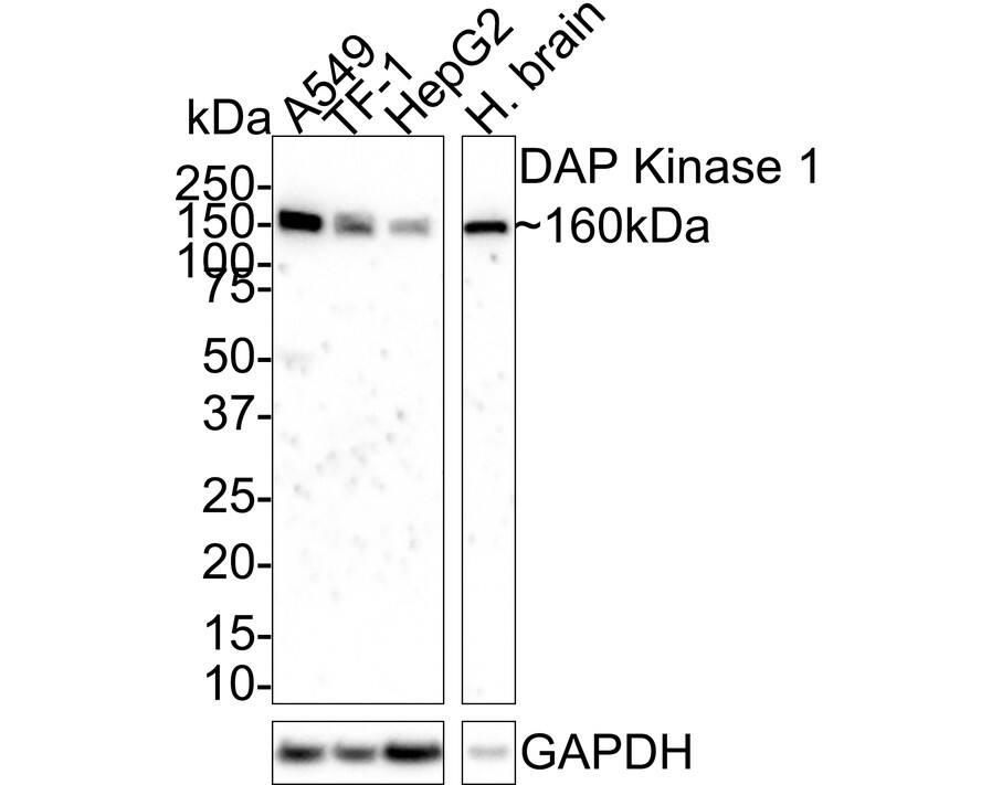 DAP Kinase 1 Antibody (12B2-R)