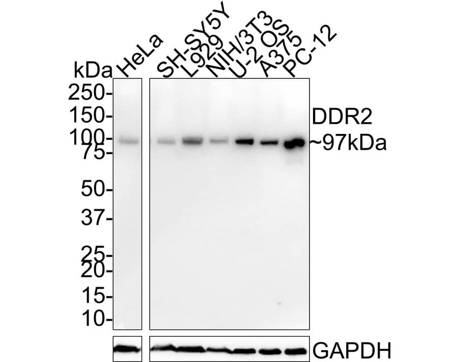 DDR2 Antibody (JE31-45)