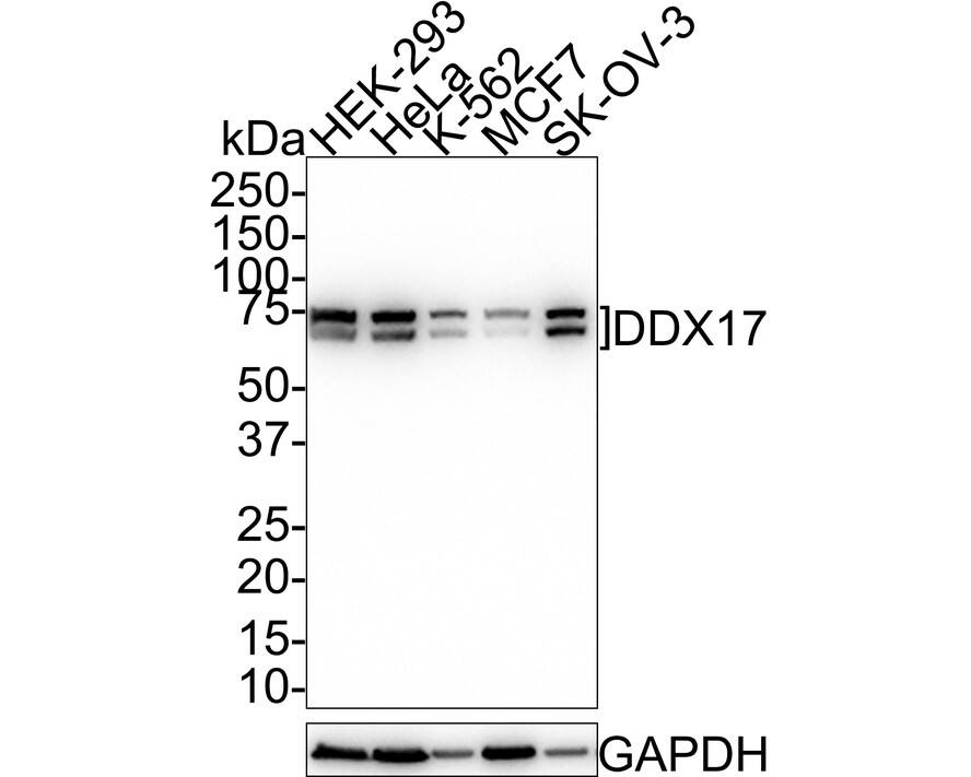 DDX17 Antibody (JE35-01)