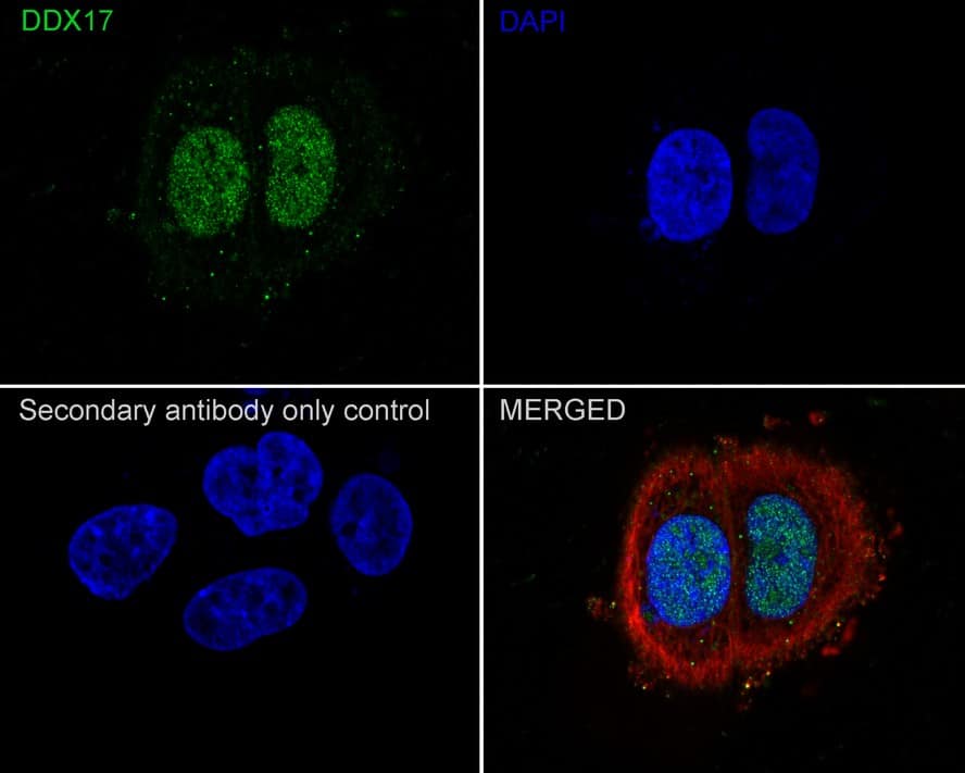 DDX17 Antibody (JE35-01)