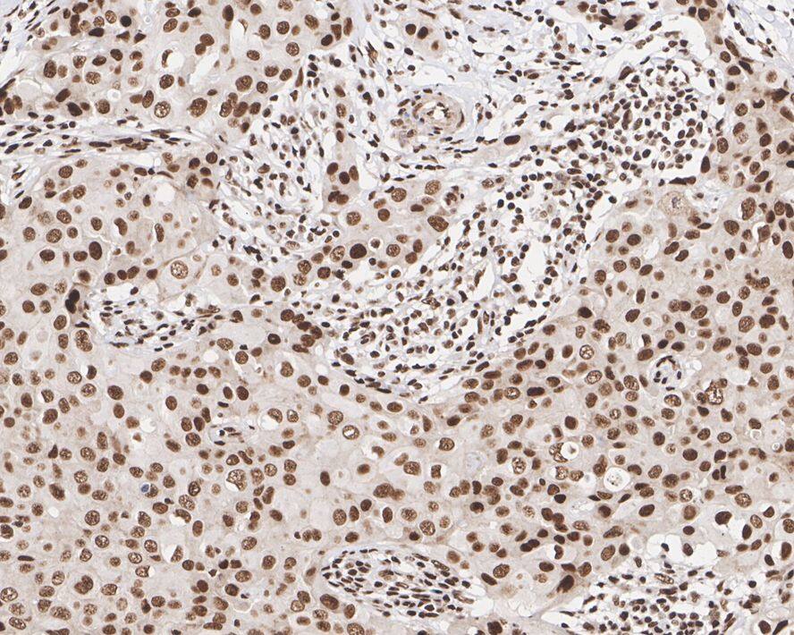DDX17 Antibody (JE35-01)