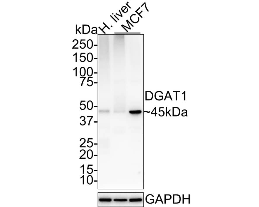 DGAT1 Antibody (JE34-88)