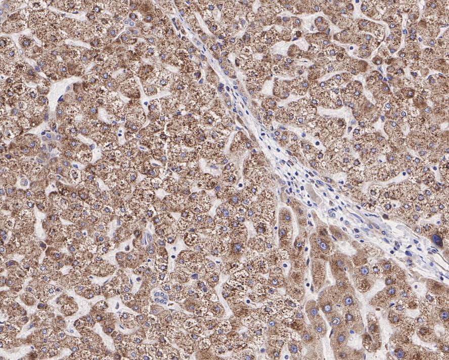 DGAT1 Antibody (JE34-88)