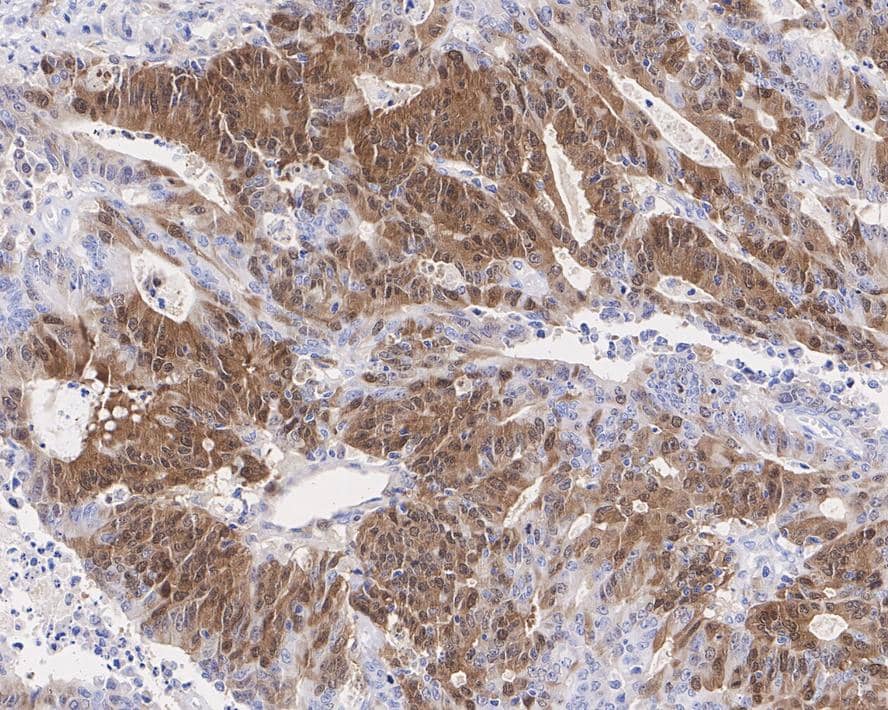 Dihydrofolate Reductase/DHFR Antibody (JE31-05)