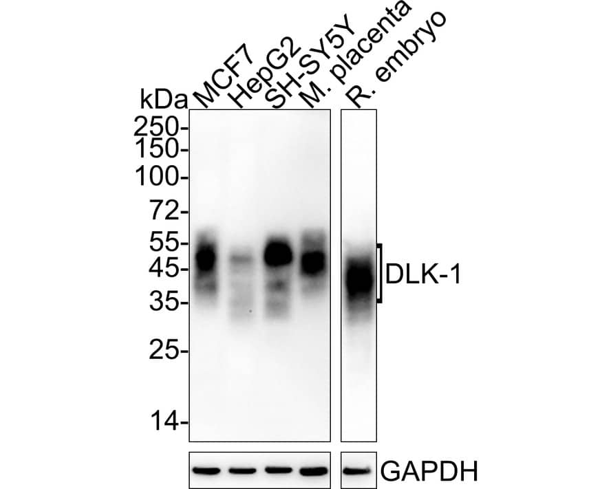 Pref-1/DLK1/FA1 Antibody (PSH04-76)