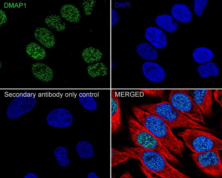 DMAP1 Antibody (JE55-31)
