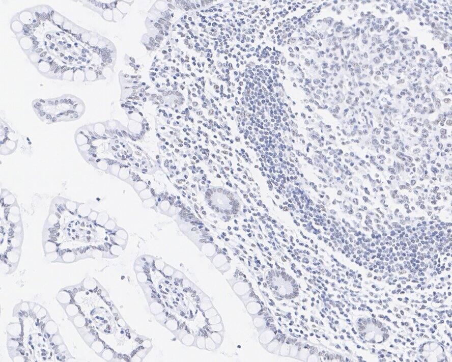 DMAP1 Antibody (JE55-31)